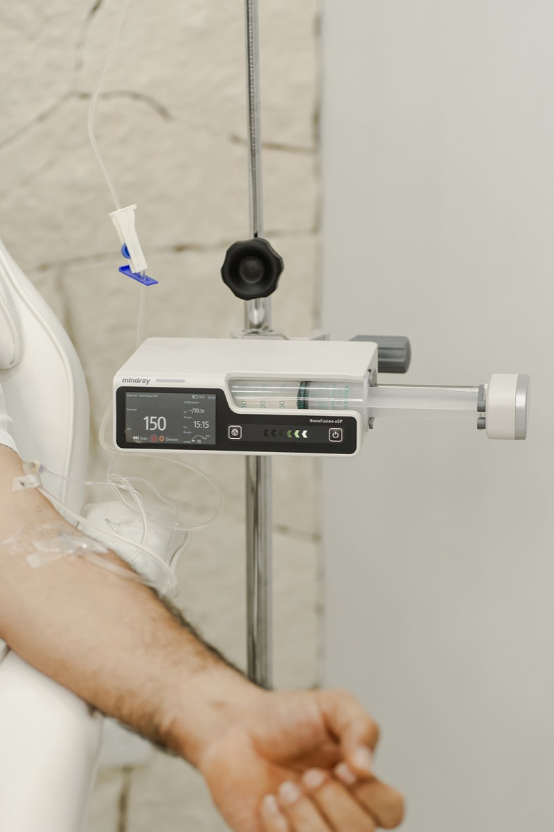 Advanced intravenous stem cell therapy being administered with a precise infusion pump at our Cancún clinic.