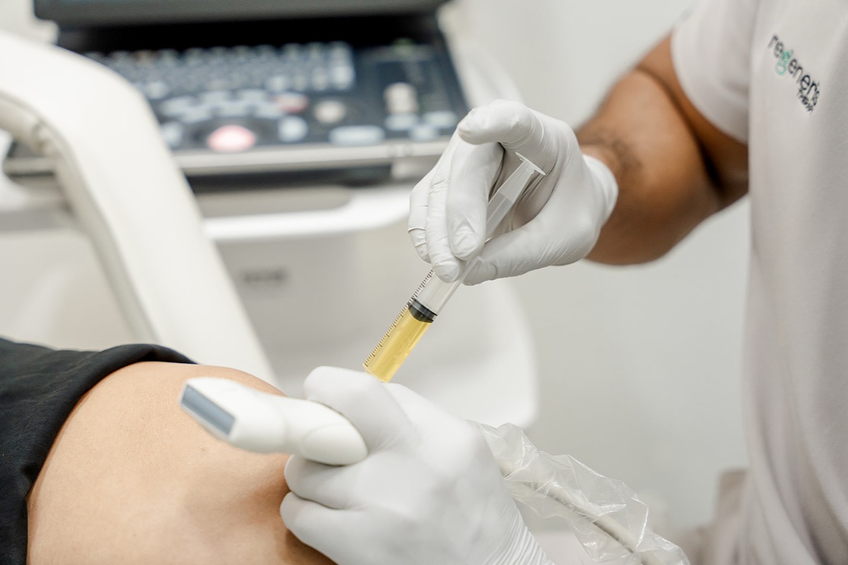PRP procedure at Regeneris