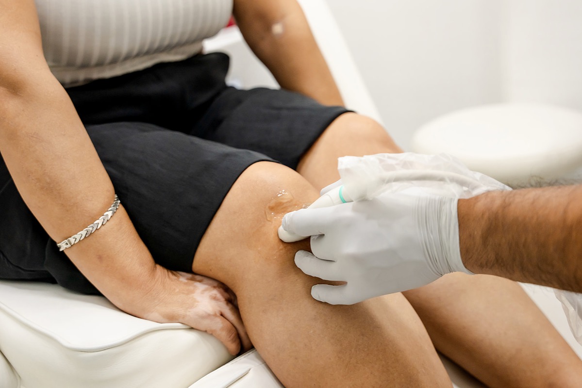 Knee ultrasound examination at Regeneris